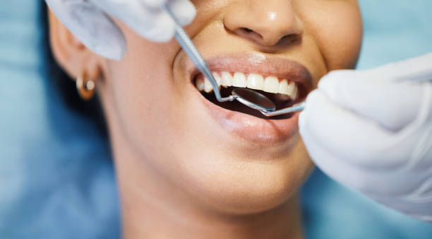 Best Emergency Cosmetic Dentistry (e.g., broken veneers) in Selah, WA